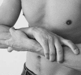 Wie kann man eine leichte Gynäkomastie natürlich reduzieren?