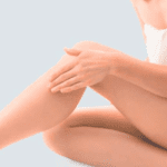 Entfernung von Besenreisern an den Beinen: Gefäßlaser vs. Mikroschaum-Sklerotherapie