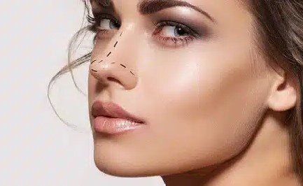 Nasenkorrektur Risiken