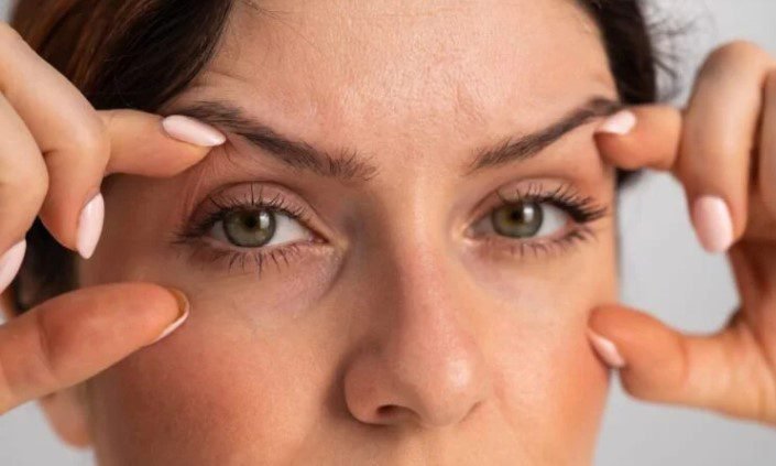 lidstraffung ohne op vorher-nachher