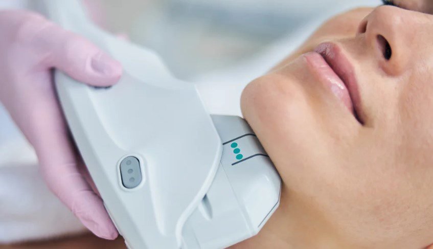 Warum SMAS Facelifting?