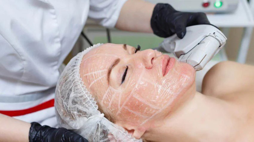 SMAS Facelifting vs. andere Facelift-Methoden