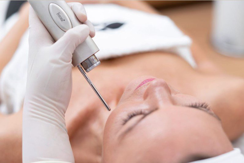 Für wen ist Laser Facelifting geeignet