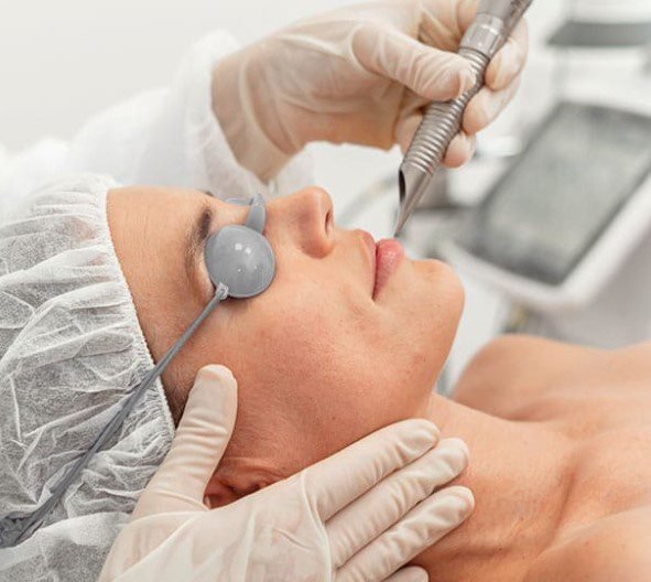 Laser Faceliftings in Deutschland