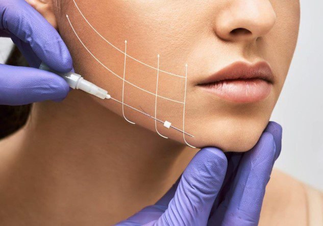 Kosten des Faceliftings mit Fäden