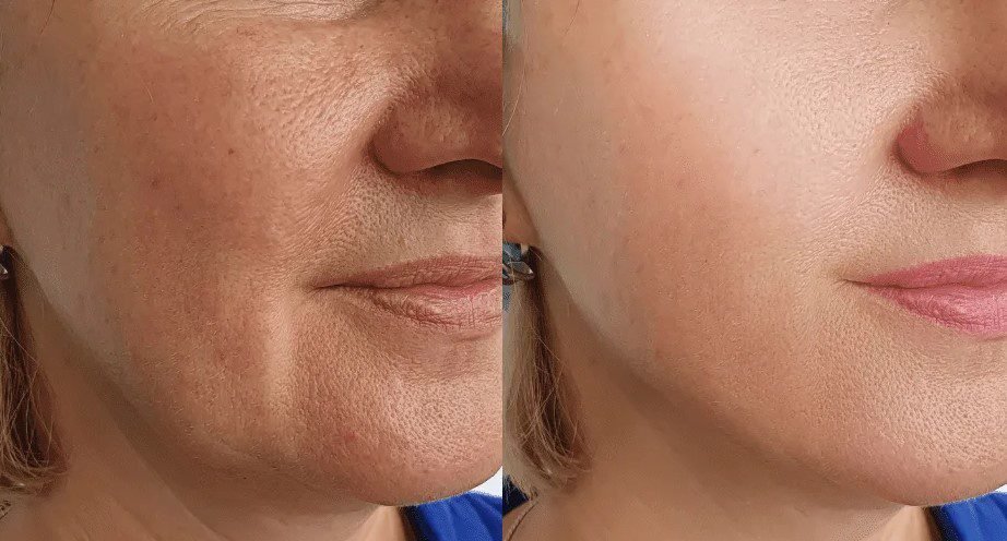 Vorbereitung und Nachsorge