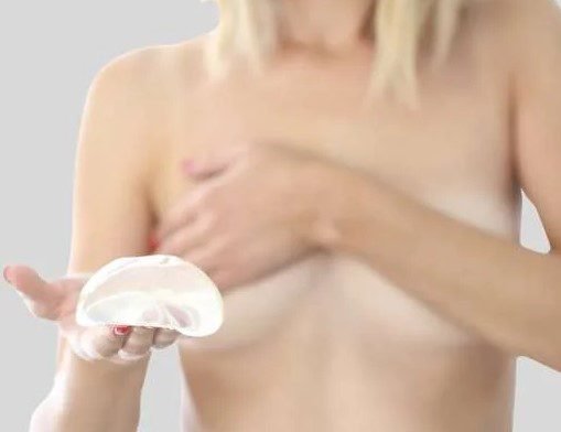 Bruststraffung mit oder ohne Implantat