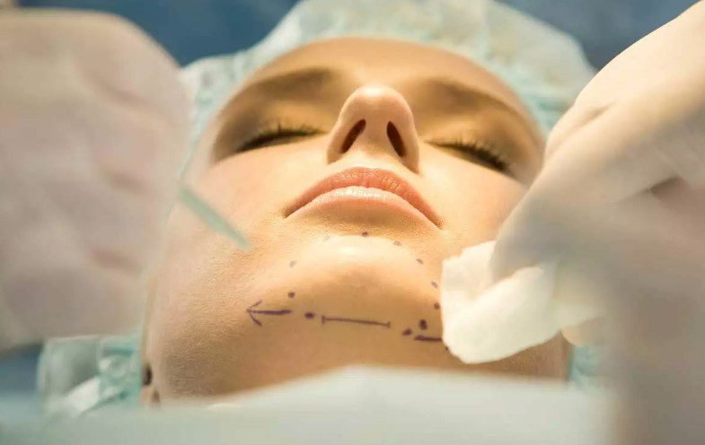 hervorstehendes kinn op