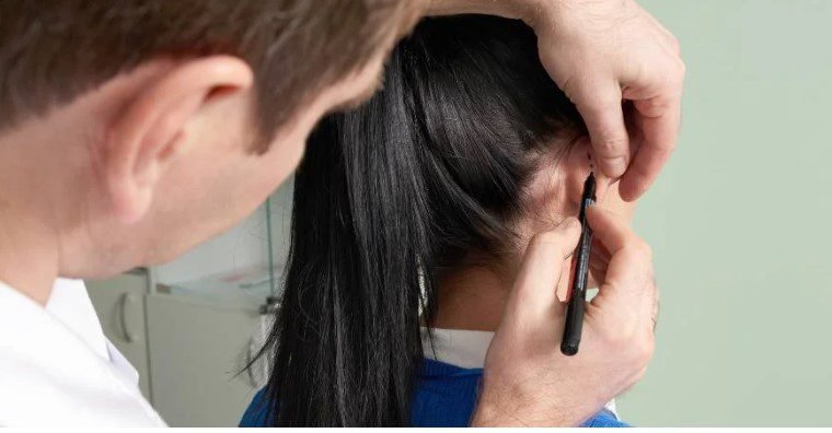 Ohren anlegen Kosten