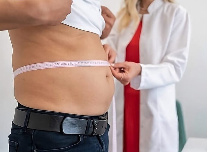 Liposuktion Männer Kosten