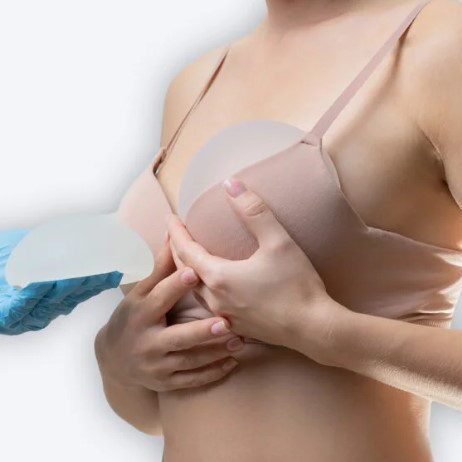 Brustaufbau Methoden: Eigengewebe oder Implantat?